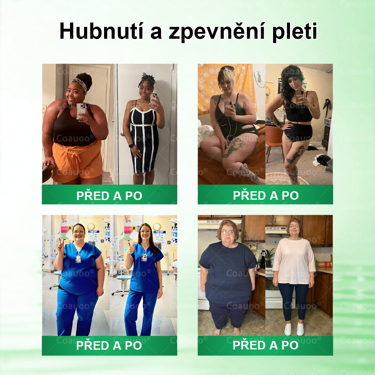 Oficiální prodejna BENU |  🧑‍⚕️𝐂𝐨𝐚𝐮𝐨𝐨® 𝐌𝐨𝐫𝐢𝐧𝐠𝐚 × 𝐁𝐞𝐫𝐛𝐞𝐫𝐲𝐧𝐚 × 𝐀𝐌𝐏𝐊 𝟏𝟎 v 1 – Zeštíhlující nano mikrojihlový náplast 🇨🇿 Jen 1× denně ✅ Viditelné změny za 7 dní – na obezitu, kardiovaskulární zdraví, diabetes a kloubní problémy